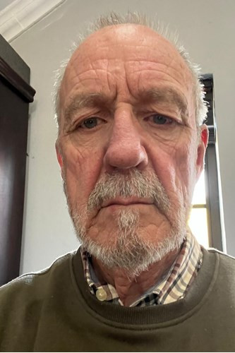Malcolm Hack